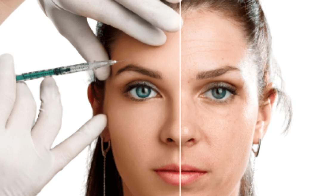 le Botox et le filler changent l’apparence du visage ?
