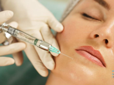 Qu’est-ce que les injections de fillers ? Comprendre l’essentiel