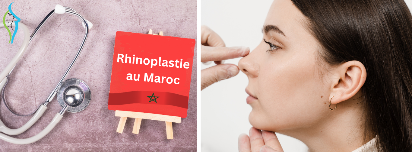 Rhinoplastie-au-maroc
