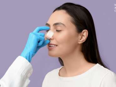 Rhinoplastie secondaire : que faire lorsque le nez a déjà été opéré au moins une fois ?