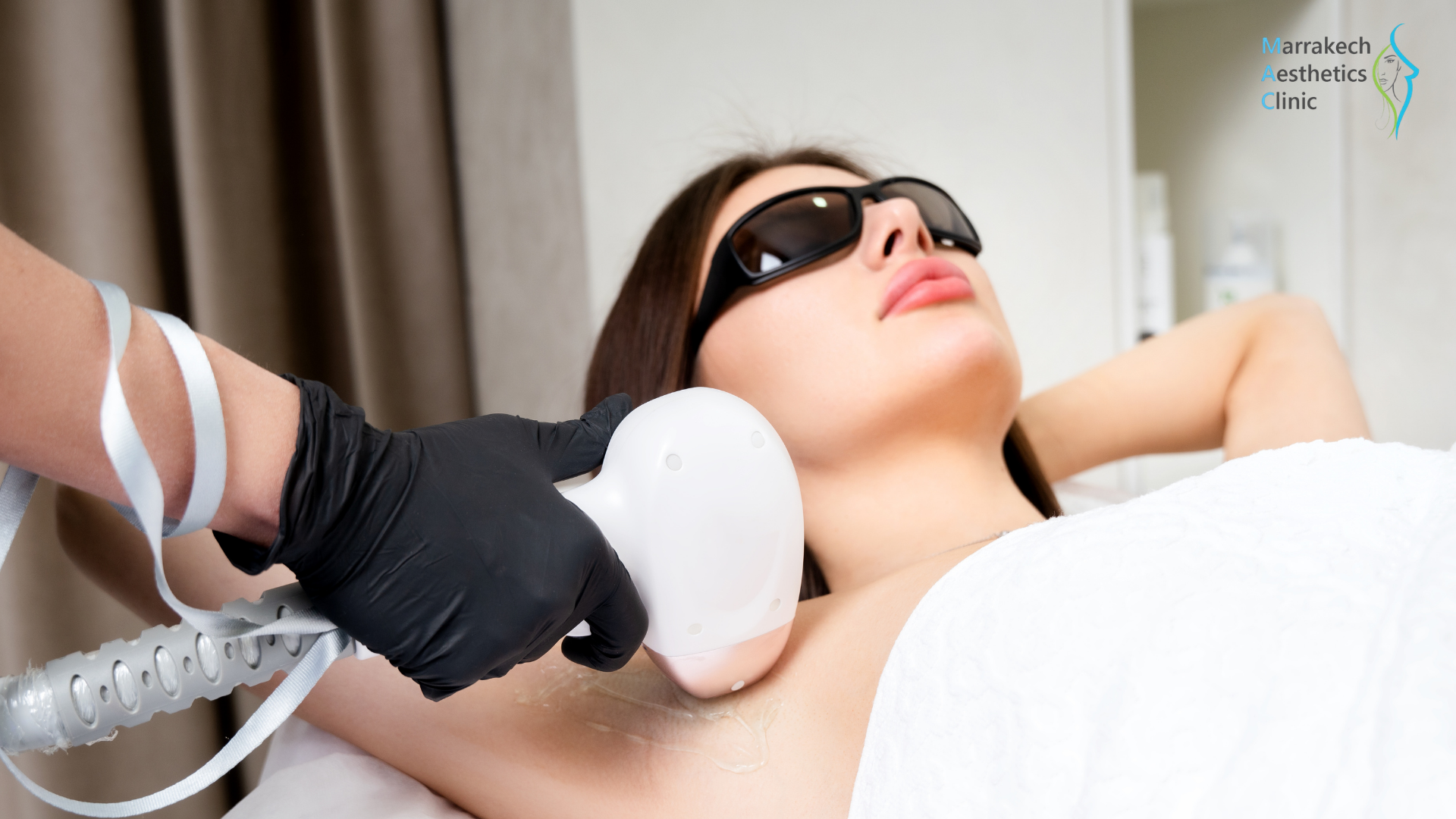epilation laser